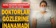 Egekent Hastanesi'nde genç kadının karnından 20 Kg. ur çıkarıldı